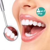آیا سفید کردن دندان برای افراد مختلف تاثیر مشابه دارد؟