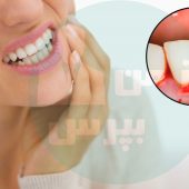 اگر دوست دارید دندان هایتان سفید شوند این مقاله را بخوانید