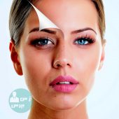 هرآنچه درخصوص لایه برداری پوست باید بدانید