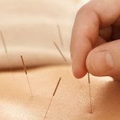 طب سوزنی و تاثیرات آن بر کاهش درد ناشی از سرطان سینه