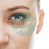 راه های درمان گودی زیر چشم