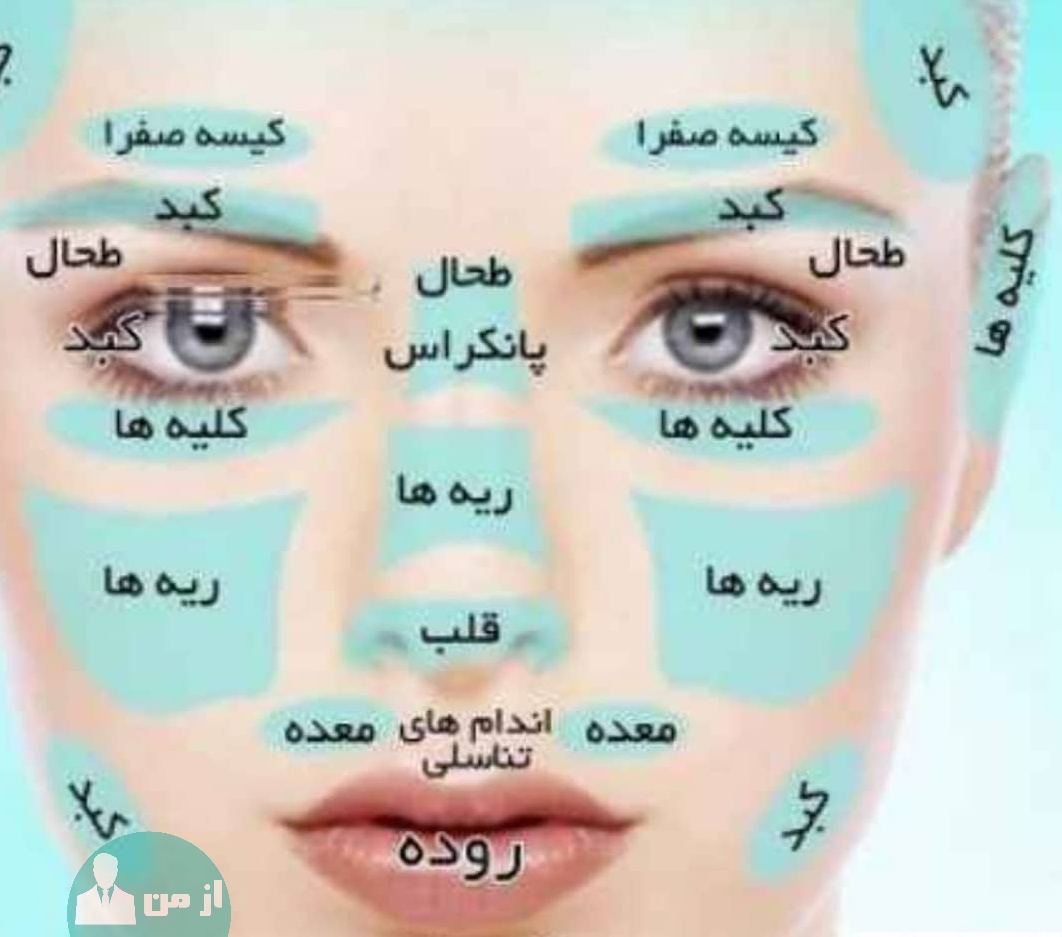 تشخیص بیماری با مشاهده چهره